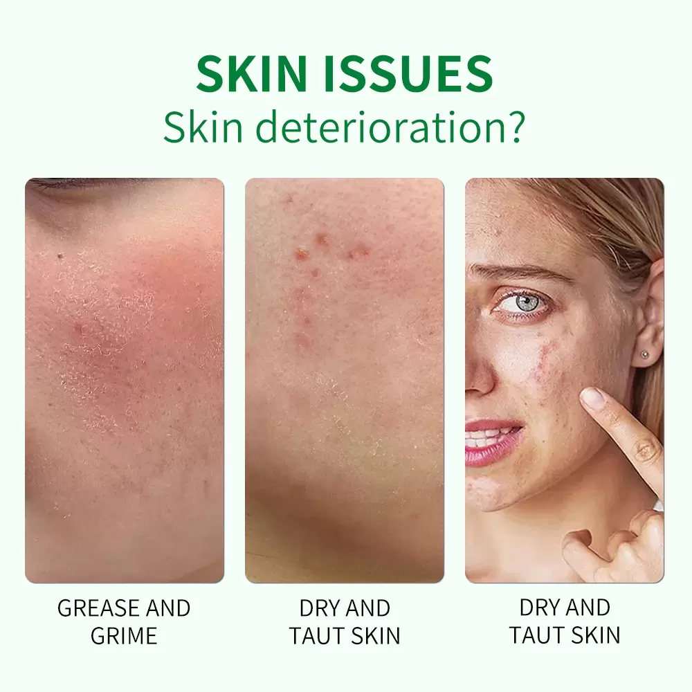 保湿透明嫩滑芦荟凝胶_04