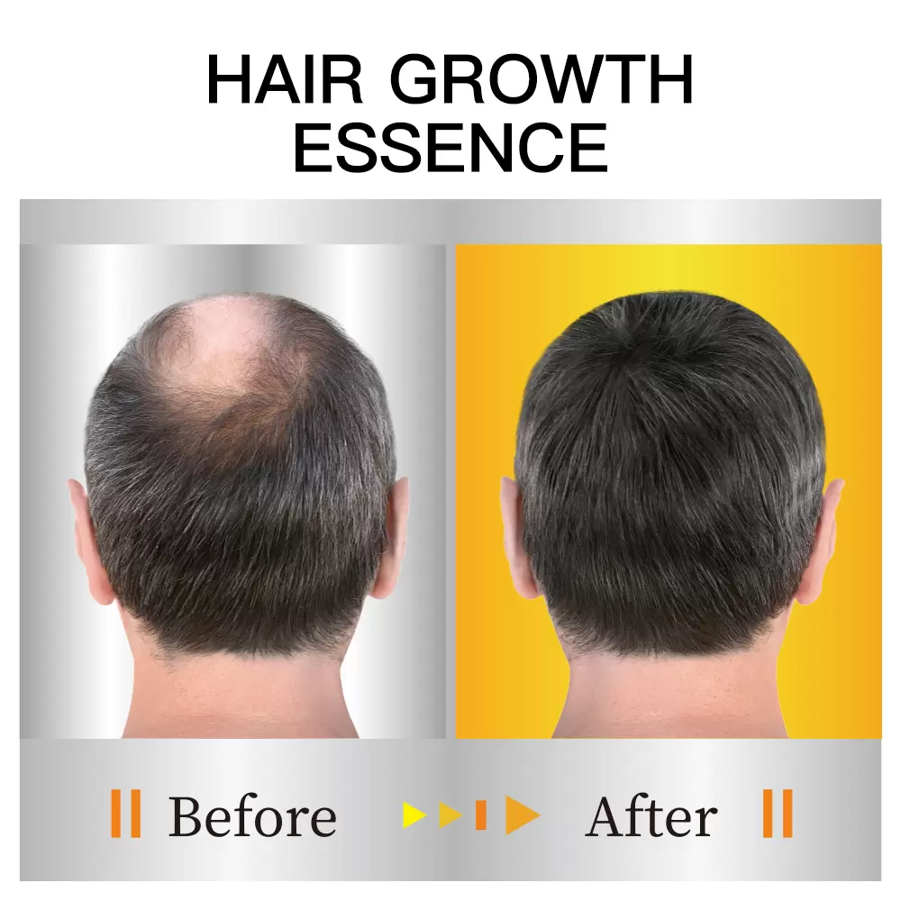 头皮养护精华精油_03